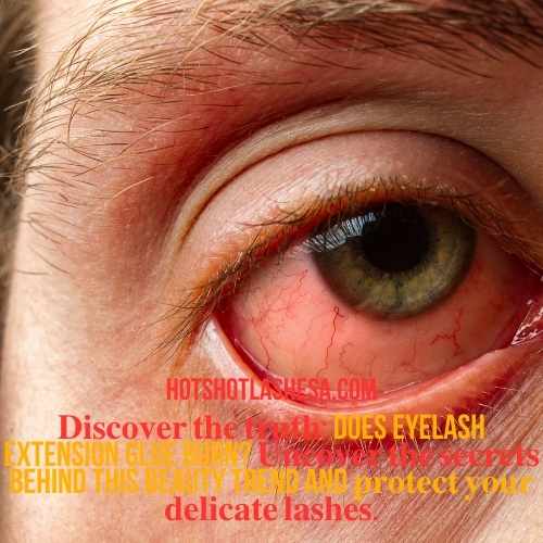 Does Eyelash Extension Glue Burn